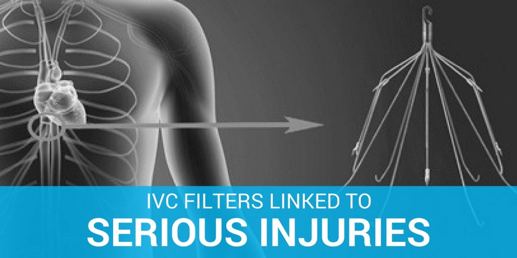 Study Reveals 43 Perforation Risk With Cook IVC Filter