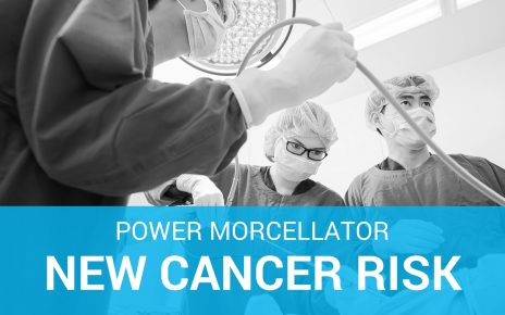 Power Morcellator Surgery Spreading Cancer
