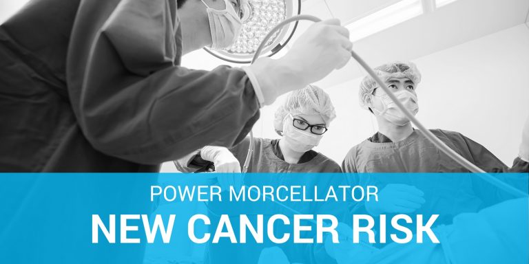 Power Morcellator Surgery Spreading Cancer