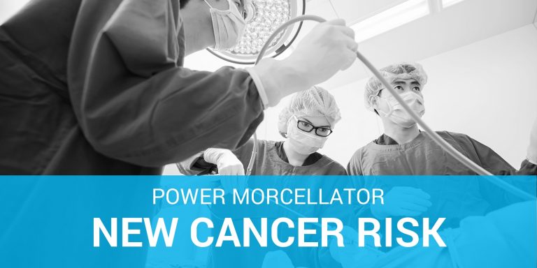 power morcellator cancer risk