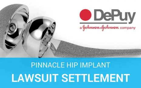 depuy pinnacle hip implant lawsuit settlement