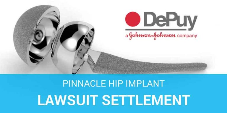 depuy pinnacle hip implant lawsuit settlement