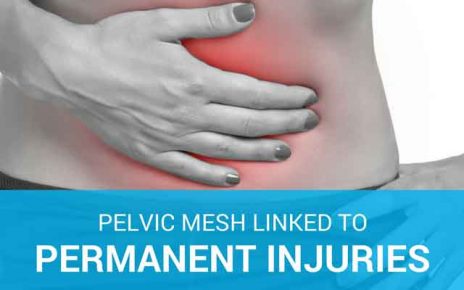 Pelvic mesh linked to permanent injuries