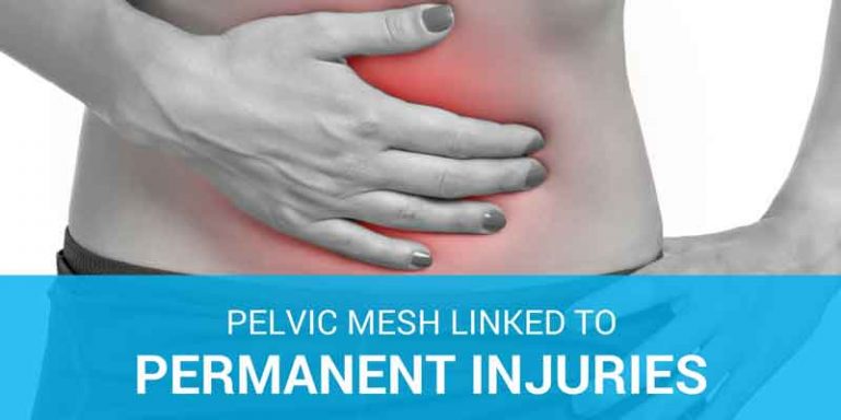 Pelvic mesh linked to permanent injuries