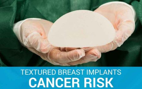 Breast Implants Cancer Risk & Complications Featured Image; breast implants cancer risk