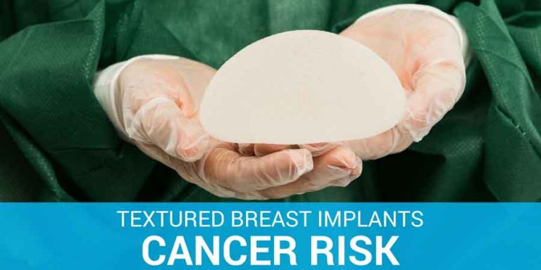 Breast Implants Cancer Risk & Complications Featured Image; breast implants cancer risk