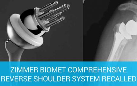 zimmer recalls reverse shoulder device