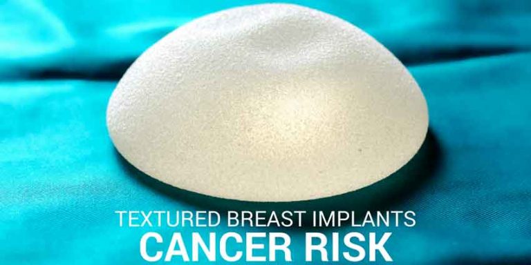 textured breast implant mentor implants recall