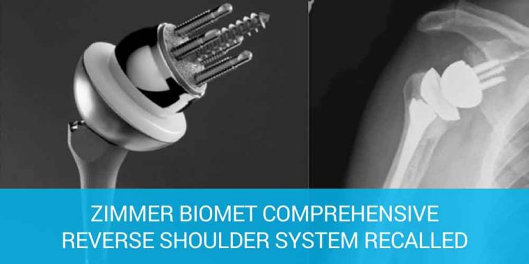 Zimmer Shoulder Replacement