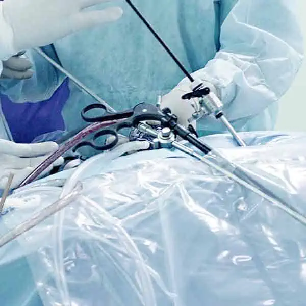 Physiomesh Laparoscopic Hernia Repair Surgery