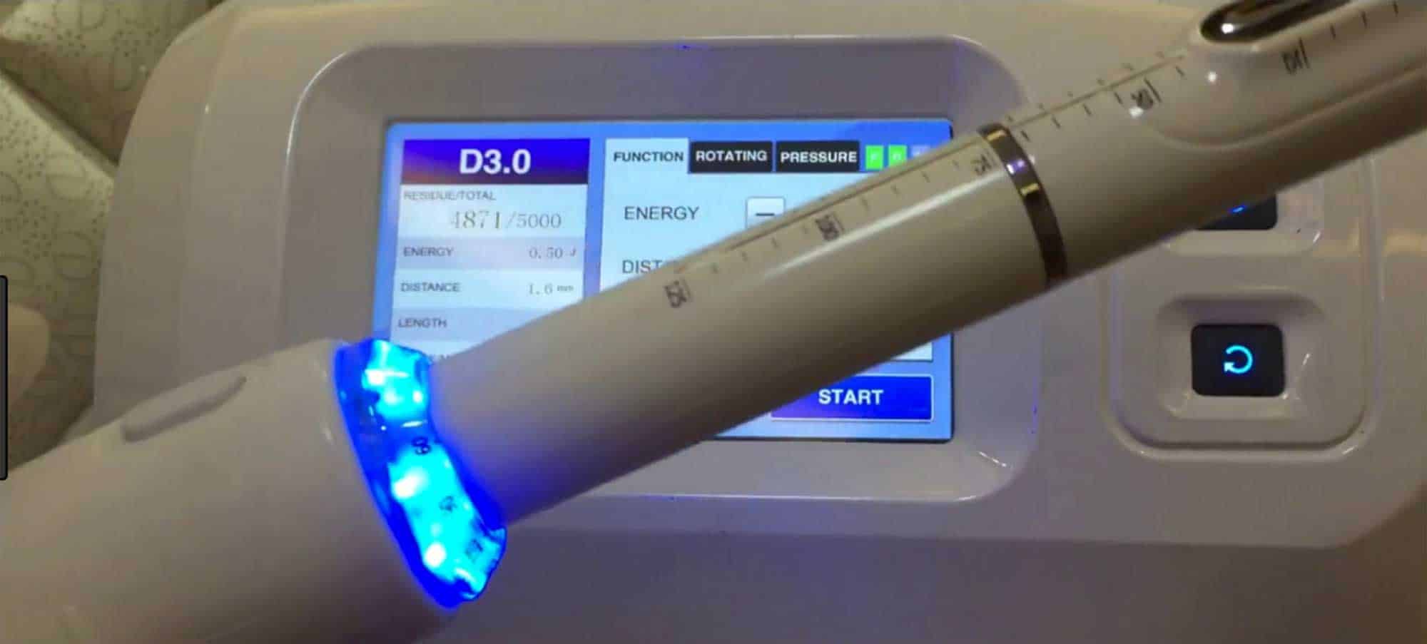 Vaginal Rejuvenation Lawsuit TruLaw