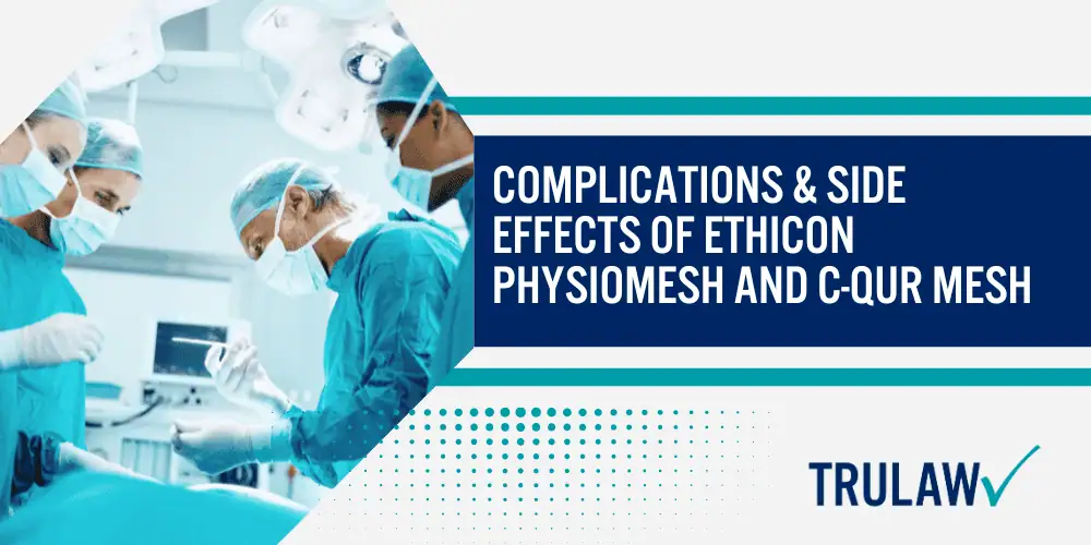 Hernia Mesh Lawsuit; Faulty Hernia Mesh Products Lead To Recurrence And Re-operations; Ethicon Physiomesh Composite Mesh Recalled Because Of High Rate Of Complications; Hernia Mesh Lawsuits; Complications & Side Effects of Ethicon Physiomesh And C-Qur Mesh