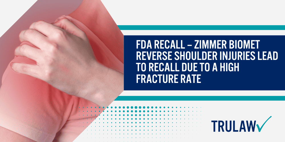 Zimmer Biomet Faulty Reverse Shoulder Implant Device; What Is A Reverse Shoulder Replacement Surgery; Zimmer Biomet Comprehensive Reverse Shoulder System; FDA RECALL – Zimmer Biomet Reverse Shoulder Injuries Lead To Recall Due To A High Fracture Rate