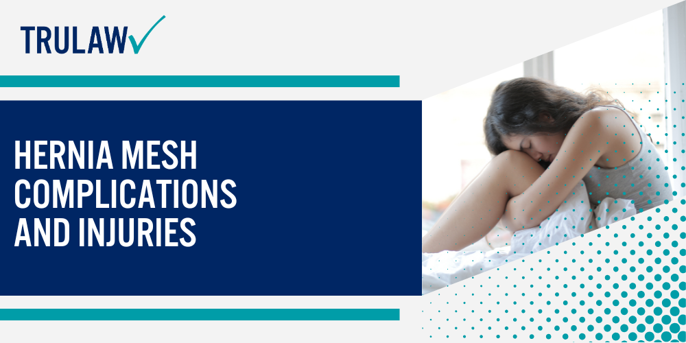 Common Defendants and Their Mesh Products; Hernia Mesh Complications and Injuries