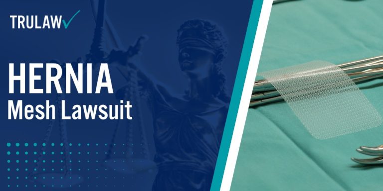 Hernia Mesh Lawsuit; Faulty Hernia Mesh Products Lead To Recurrence And Re-operations; Ethicon Physiomesh Composite Mesh Recalled Because Of High Rate Of Complications; Hernia Mesh Lawsuits; Complications & Side Effects of Ethicon Physiomesh And C-Qur Mesh; C-Qur V-Patch Mesh Recall; Bard Hernia Mesh Lawsuits 2018; What Is A Laparoscopic Hernia Repair; Was The Hernia Mesh Used in My Hernia Repair Recalled; Recalled Ethicon Physiomesh Composite Mesh Products; If I Believe My Mesh Product Was Recalled What Should I Do; Common Defendants and Their Mesh Products; Hernia Mesh Complications and Injuries; Immediate and Short-Term Complications; Long-Term and Chronic Complications; Current Status of Hernia Mesh Litigation; Eligibility and Legal Process for Filing a Hernia Mesh Lawsuit; Qualifying for a Hernia Mesh Claim; The Legal Process and What to Expect; Compensation and Settlement Values in Hernia Mesh Cases; Factors Affecting Settlement Amounts; Types of Damages Available in Hernia Mesh Cases; How Can A Hernia Mesh Attorney from TruLaw Help You