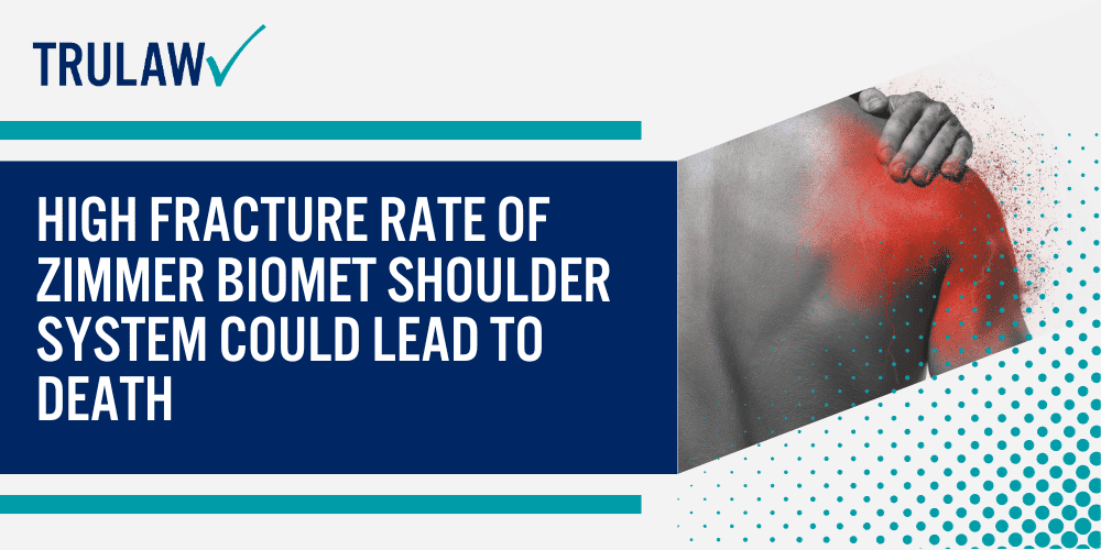 Zimmer Biomet Faulty Reverse Shoulder Implant Device; What Is A Reverse Shoulder Replacement Surgery; Zimmer Biomet Comprehensive Reverse Shoulder System; FDA RECALL – Zimmer Biomet Reverse Shoulder Injuries Lead To Recall Due To A High Fracture Rate; High Fracture Rate Of Zimmer Biomet Shoulder System Could Lead To Death