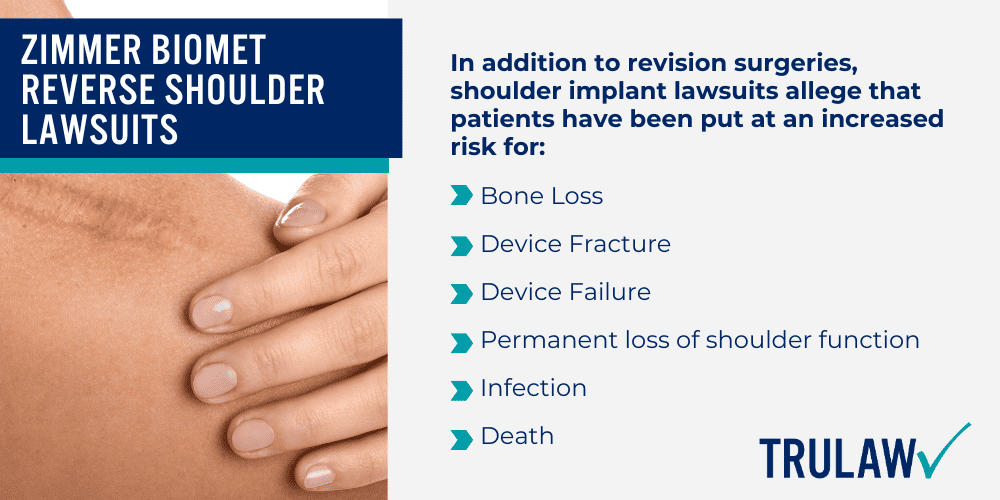Zimmer Biomet Faulty Reverse Shoulder Implant Device; What Is A Reverse Shoulder Replacement Surgery; Zimmer Biomet Comprehensive Reverse Shoulder System; FDA RECALL – Zimmer Biomet Reverse Shoulder Injuries Lead To Recall Due To A High Fracture Rate; High Fracture Rate Of Zimmer Biomet Shoulder System Could Lead To Death; Zimmer Biomet Shoulder Replacement Timeline; Zimmer Biomet Reverse Shoulder Lawsuits