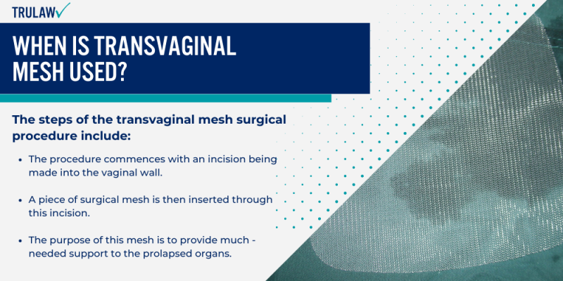 Transvaginal Mesh Alternatives Trulaw