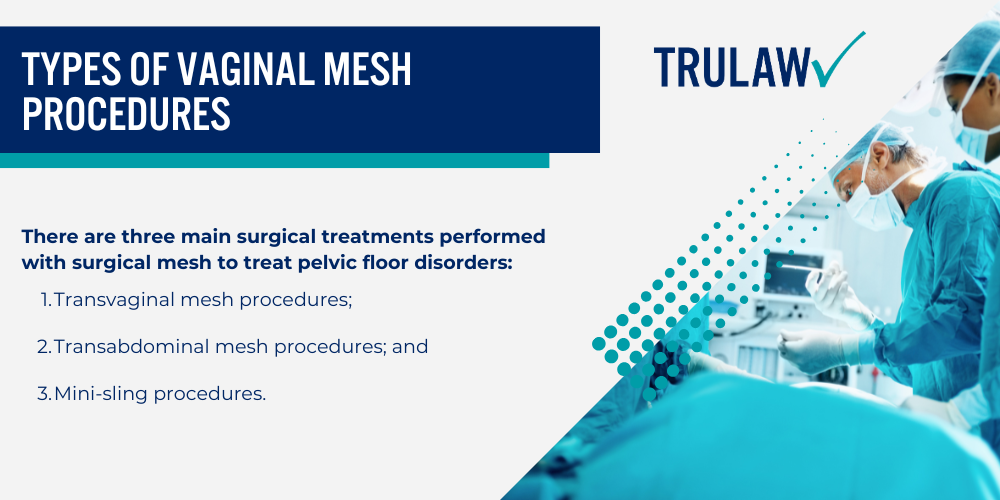 Types of Vaginal Mesh Procedures