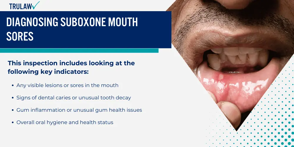 Diagnosing Suboxone Mouth Sores