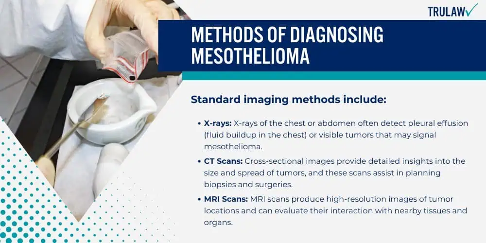 Methods of Diagnosing Mesothelioma