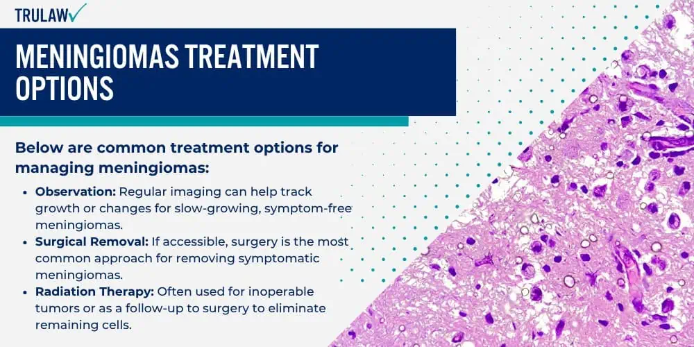 Meningiomas Treatment Options
