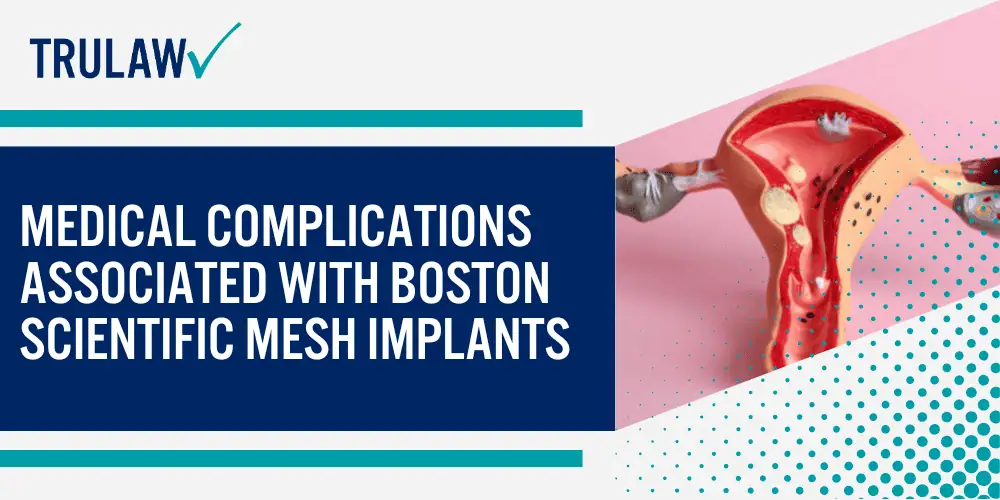 Boston Scientific Vaginal Mesh Devices and Their Intended Medical Purpose; Boston Scientific Vaginal Mesh Devices and Their Intended Medical Purpose; Medical Complications Associated with Boston Scientific Mesh Implants