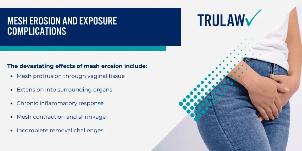 Boston Scientific Vaginal Mesh Devices and Their Intended Medical Purpose; Boston Scientific Vaginal Mesh Devices and Their Intended Medical Purpose; Medical Complications Associated with Boston Scientific Mesh Implants; Mesh Erosion and Exposure Complications
