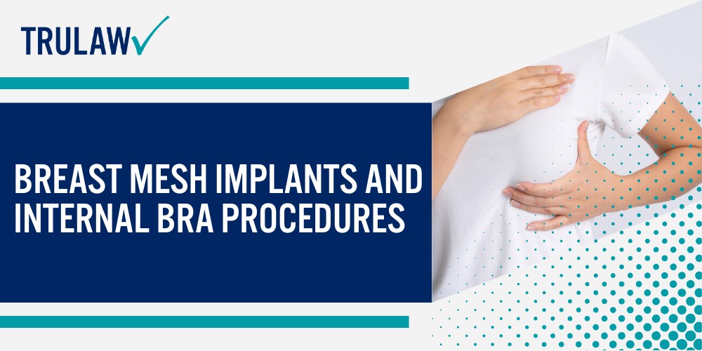 Breast Mesh Implants and Internal Bra Procedures