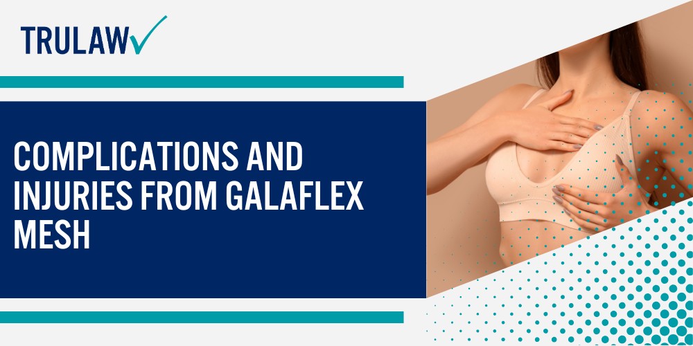 What is GalaFlex 3D Scaffold Mesh; FDA Clearance and Off-Label Use; Complications and Injuries from GalaFlex Mesh