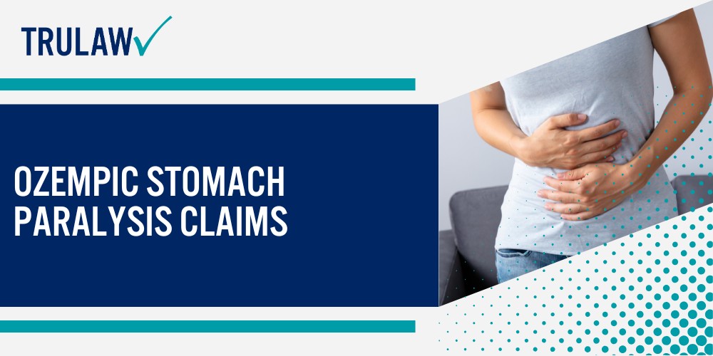 What is Ozempic and How Does It Work?; What is NAION (Non-Arteritic Anterior Ischemic Optic Neuropathy); What is Ozempic and How Does It Work?; What is NAION (Non-Arteritic Anterior Ischemic Optic Neuropathy); Symptoms and Characteristics of NAION; Scientific Evidence Linking Ozempic to Blindness; Current Ozempic Lawsuit Developments; Ozempic Stomach Paralysis Claims