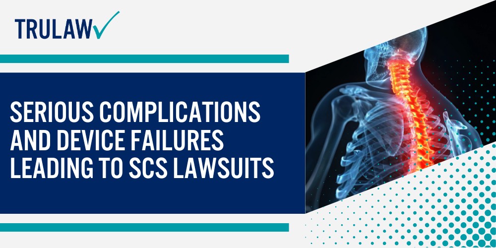 Medtronic Spinal Cord Stimulators and Their Intended Purpose; Evolution of Medtronic’s Spinal Cord Stimulator Technology; The FDA Approval Process and Supplemental Changes; Patient Expectations Versus Reality; Serious Complications and Device Failures Leading to SCS Lawsuits