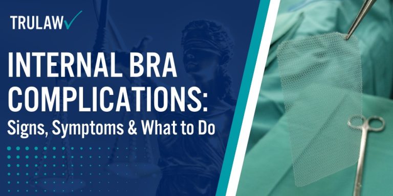 Internal Bra Complications Signs, Symptoms & What to Do