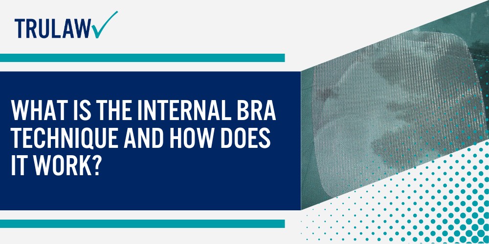 What Is the Internal Bra Technique and How Does It Work