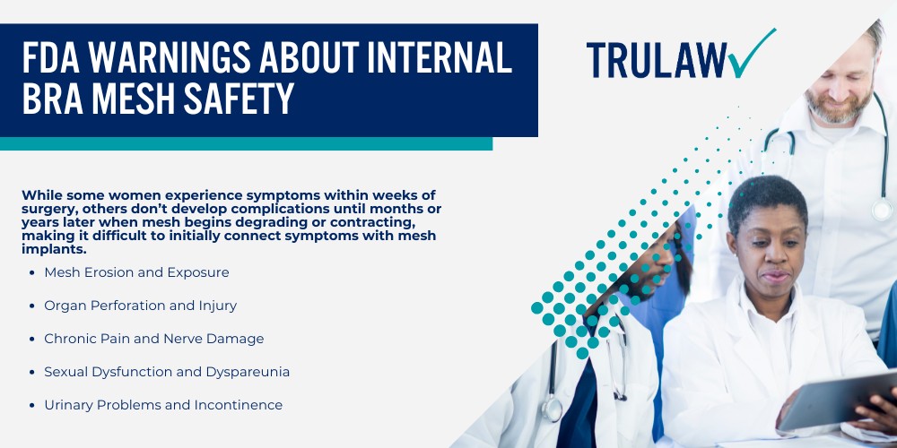 What Is the Internal Bra Technique and How Does It Work; Types of Biologic and Synthetic Meshes Used in Internal Bra Procedures; Why Breast Mesh Implants Are Used in Breast Augmentation and Reconstruction; FDA Warnings About Internal Bra Mesh Safety